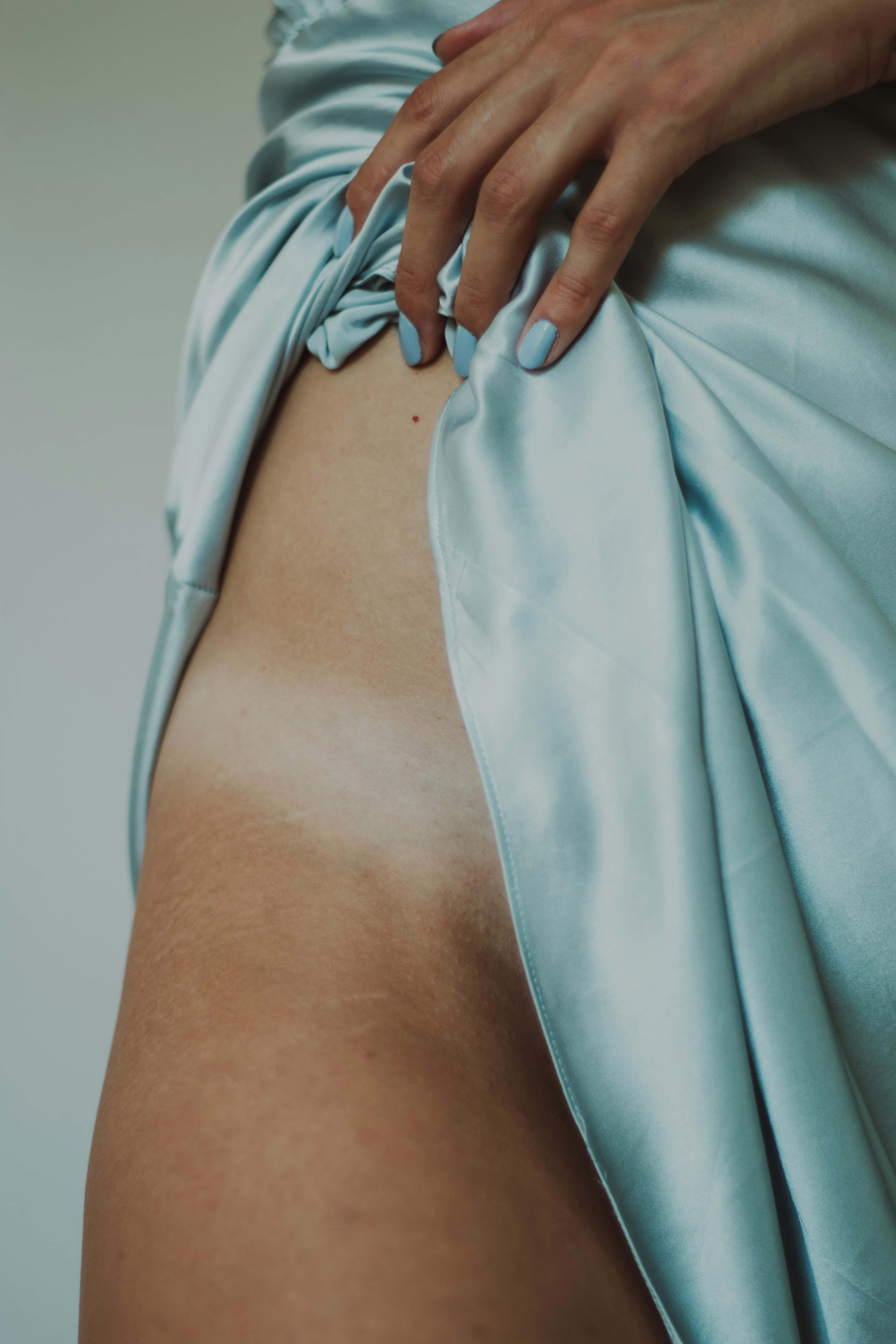 Laserska epilacija i tip kože